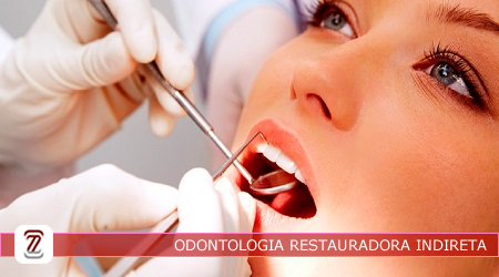 UCE311_ODONTOLOGIA RESTAURADORA INDIRETA  - NOTURNO